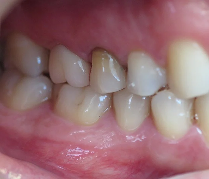 emergency dentist Gardena After