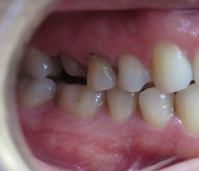 emergency dentist Gardena Before