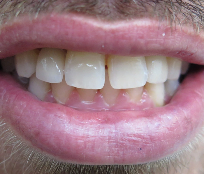 emergency dentist Gardena After