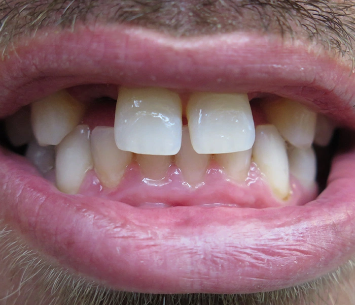 emergency dentist Gardena Before